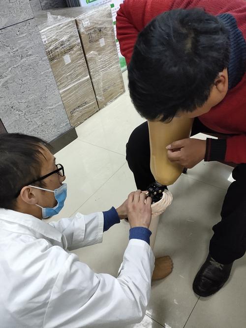 禹会区精准开展残疾人假肢,矫形器装配服务